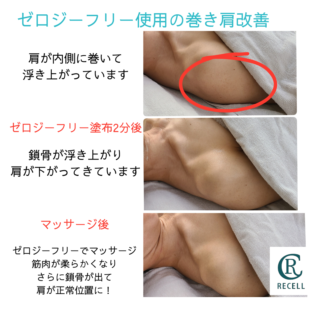わずか2分で頑固な脂肪が変わる！ゼロジーフリー | 60日で素肌革命 