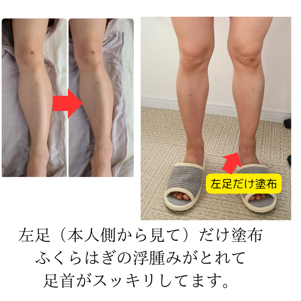 【ステキなパール様専用 】ゼロジーフリー 1000ml　ラスト1点 Zero-G-Free（ゼロジーフリー） | ソフィアビューティー − エステ商材卸