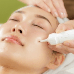 シミ取り後悔しない？シミ取り何回目で効果でる？