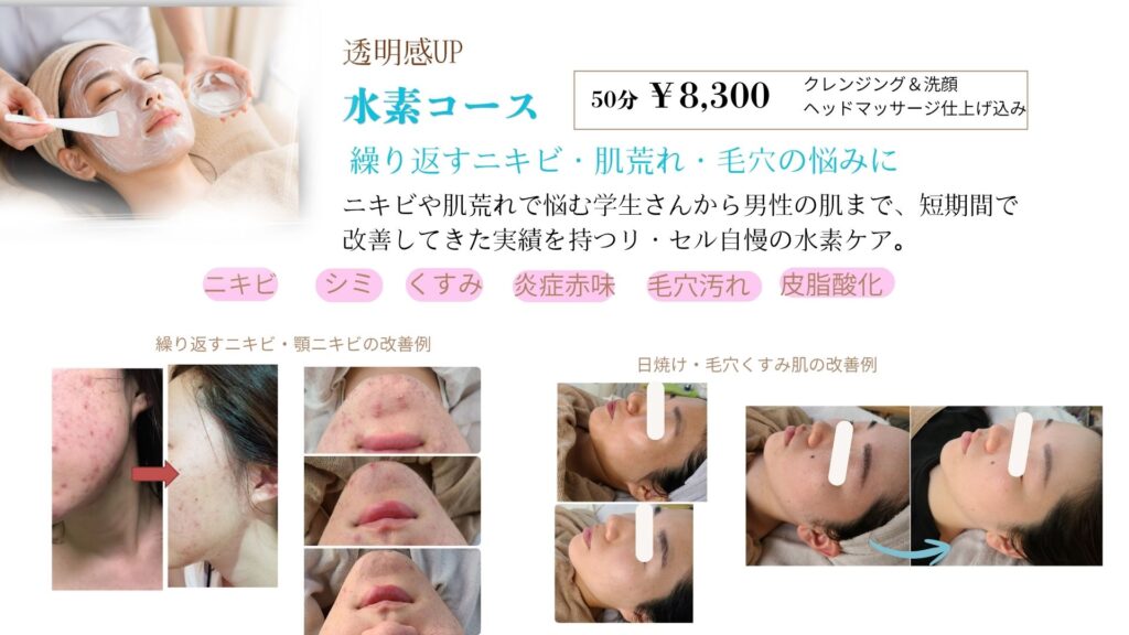 宮崎市リ・セル　ニキビ改善水素コース
