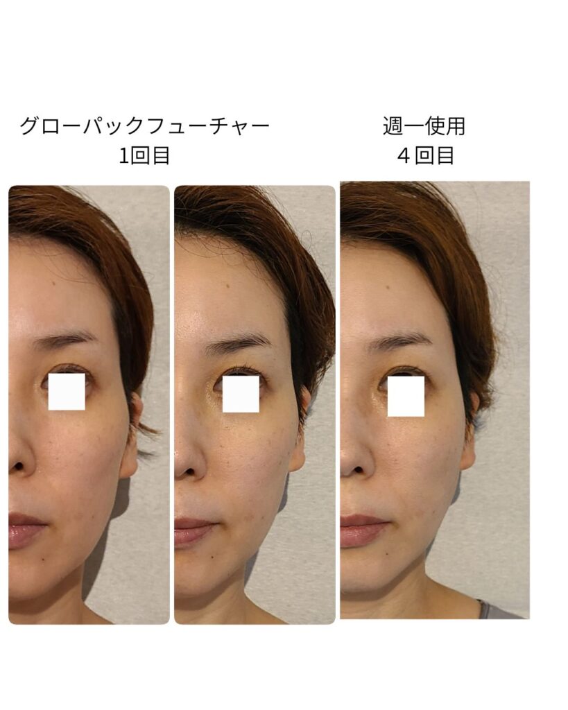 エニシーグローパックフューチャービフォーアフター写真