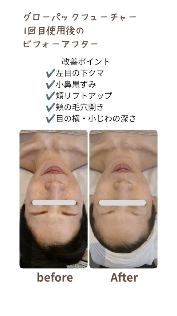 エニシーグローパックフューチャー
ビフォーアフター写真